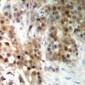 Anti-CAGE1 Antibody