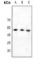 Anti-CCKAR Antibody