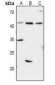 Anti-CD1d Antibody