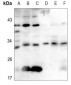 Anti-CD69 Antibody