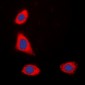 Anti-HER2 (pY1248) Antibody