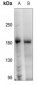 Anti-HER2 (pY1248) Antibody