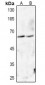 Anti-FADD (pS194) Antibody