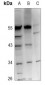 Anti-FGF13 Antibody