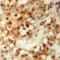 Anti-FOXO3 (pS253) Antibody