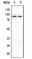 Anti-FOXO3 (pS253) Antibody