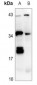 Anti-IL-26 Antibody