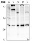 Anti-IL-6 Antibody