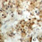 Anti-IRF3 Antibody