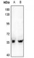 Anti-IRF3 Antibody