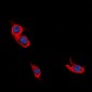 Anti-L1CAM Antibody