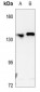 Anti-L1CAM Antibody