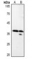 Anti-LASP1 Antibody