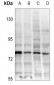 Anti-TAK1 (pT187) Antibody