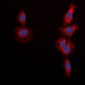 Anti-mTOR (pS2448) Antibody