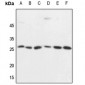 Anti-CD137 Antibody