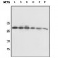 Anti-14-3-3 theta/tau (pS232) Antibody