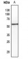 Anti-PTEN (pS380/T382/T383) Antibody