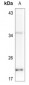 Anti-Histone H2A.X (pS139) Antibody