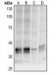 Anti-p38 (pT180/Y182) Antibody