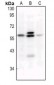 Anti-c-FOS (pS32) Antibody