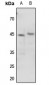 Anti-p47 phox (pS345) Antibody