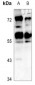 Anti-CADM1 Antibody