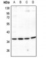 Anti-EIF3J Antibody