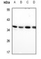 Anti-RIMS4 Antibody