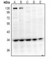 Anti-GPR40 Antibody