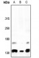 Anti-Alpha Fodrin Antibody