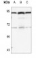 Anti-B-RAF (pS446) Antibody