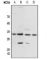 Anti-14-3-3 zeta (pT232) Antibody