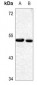 Anti-YBX1 (pS102) Antibody