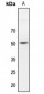 Anti-Dematin Antibody