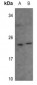 Anti-Recoverin Antibody