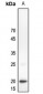 Anti-C/EBP gamma Antibody