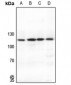 Anti-SUPT16H Antibody