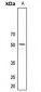 Anti-5-HT2C Antibody