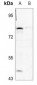 Anti-GSPT1 Antibody