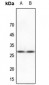 Anti-HSPB2 Antibody