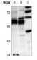 Anti-DDX19B Antibody