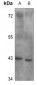 Anti-B4GALT1 Antibody