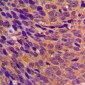 Anti-CBR3 Antibody