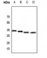 Anti-CBR3 Antibody