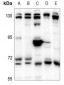 Anti-Copine 8 Antibody