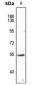 Anti-FOXN4 Antibody