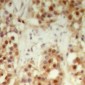 Anti-NXF3 Antibody