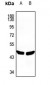 Anti-PLA1A Antibody