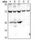 Anti-Prosaposin Antibody